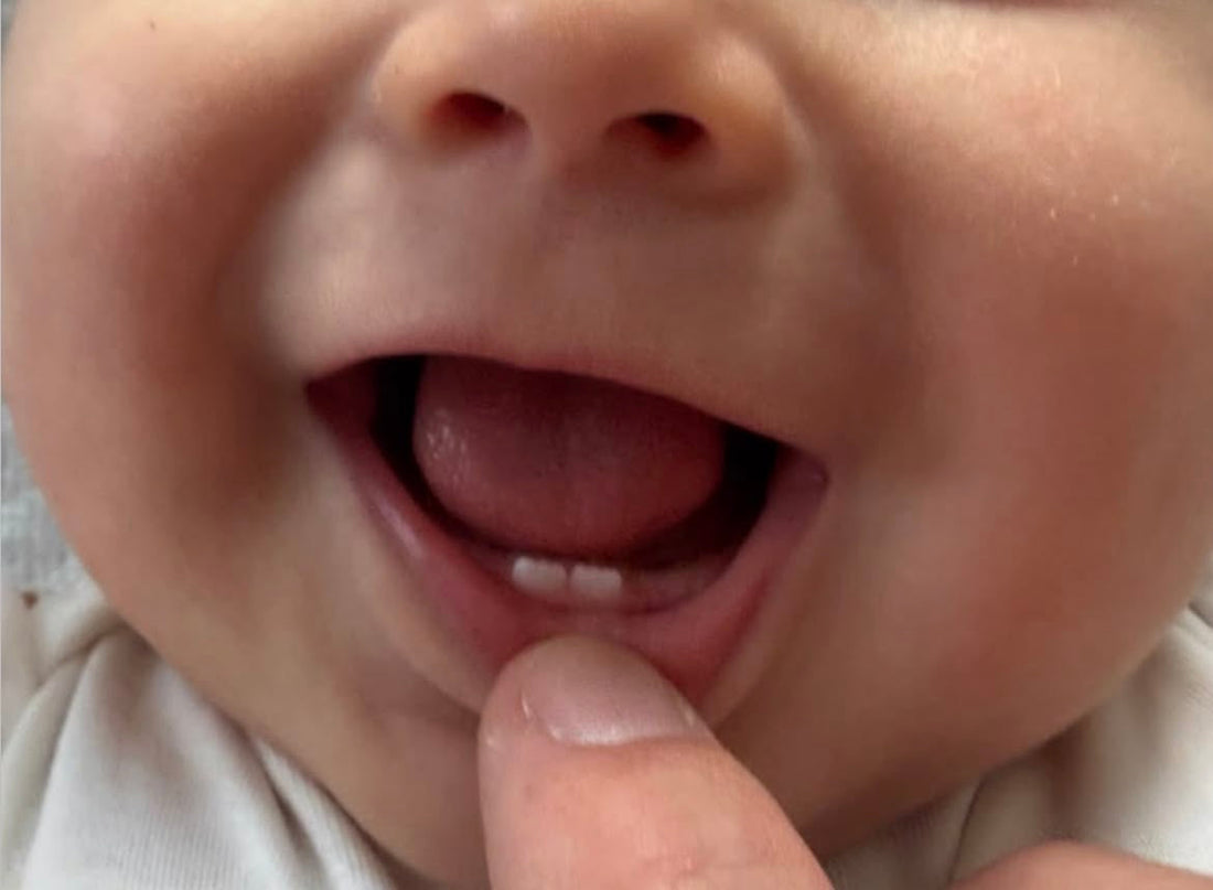 Smiling baby with first teeth beginning to come through, showing early signs of teething.
